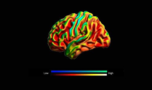 El síndrome moderno de la amígdala hiper-estimulada.